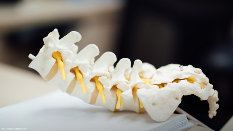 w 4 0 3, tags: bone grafting - images.unsplash.com