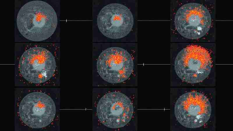 Notal Vision's AI Algorithm Paves Way for Home OCT Monitoring in Retinal Diseases, Concept art for illustrative purpose - Monok